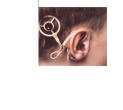 This image was borrowed from www.clevelandclinic.org/ otol/neuro/fyi.htm